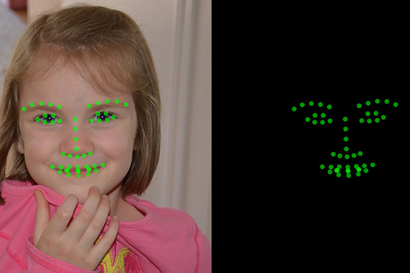 NIH leverages facial recognition software to diagnose rare